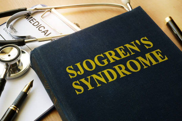 Sjogren's-syndrome-or dry-eye-syndrome