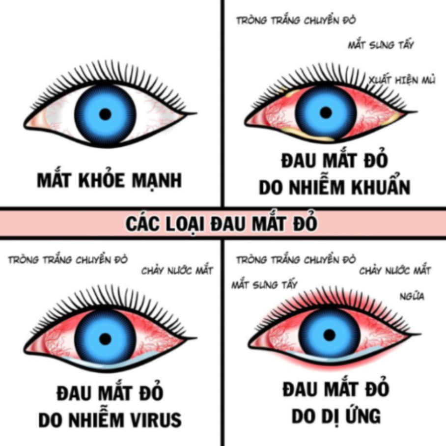 Cac-loai-dau-mat-do