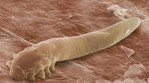 nhiem-demodex-la-nguyen-nhan-dan-den-bi-viem-mi-mat