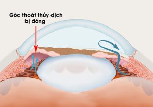 con-duong-luu-thong-thuy-dich