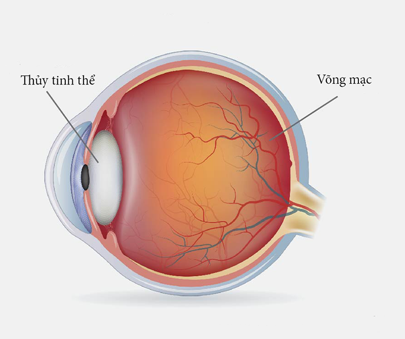 Lác mắt có thể do cấu tạo bất thường bẩm sinh của hệ vận động nhãn cầu