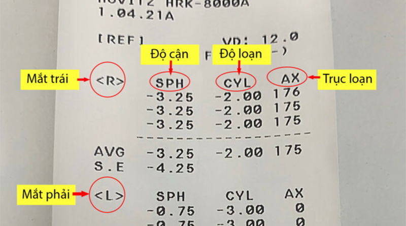 Đọc kết quả tật khúc xạ để xác định được bệnh lý của mắt