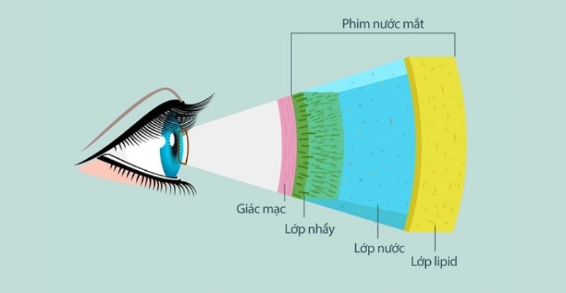 Cần thăm khám màng film nước mắt để chẩn đoán tình trạng khô mắt