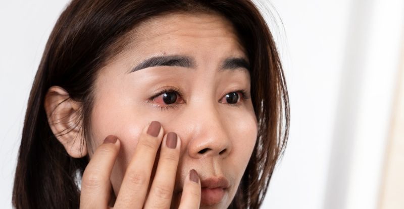 Mắt có thể trở nên nhanh mỏi sau phẫu thuật Lasik