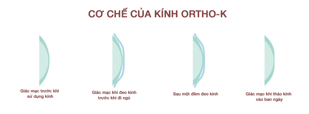 Cơ chế của phương pháp kiểm soát cận ortho-k