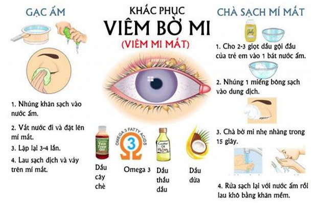 Vệ sinh mi mắt