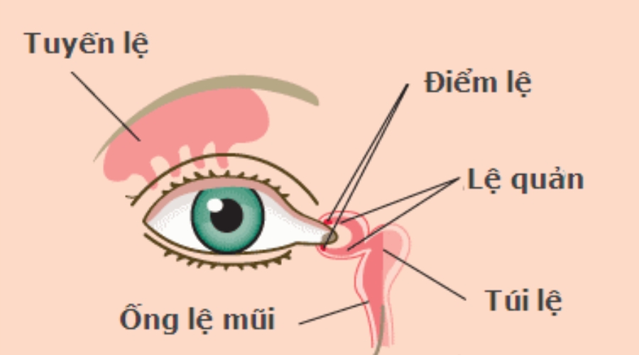 Tắc lệ đạo có thể gây ra nhiễm trùng mắt mãn tính