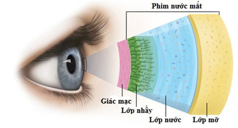 Có nên dùng nước mắt nhân tạo thường xuyên?