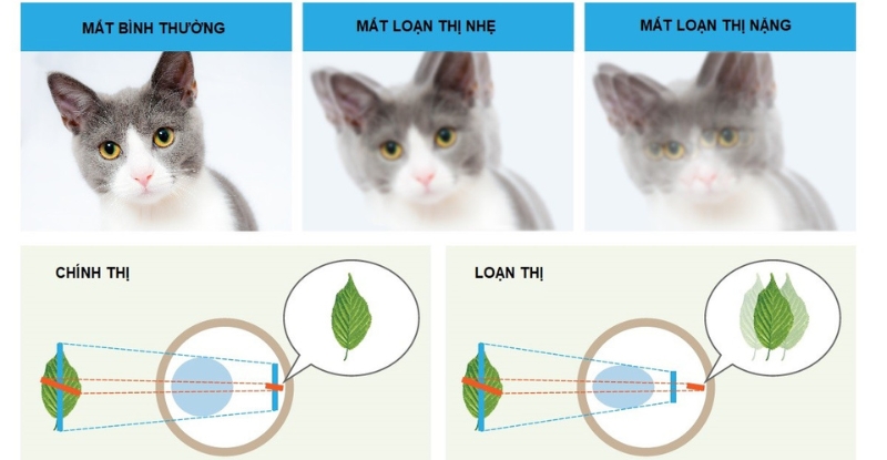 Hình ảnh trong mắt người loạn thị