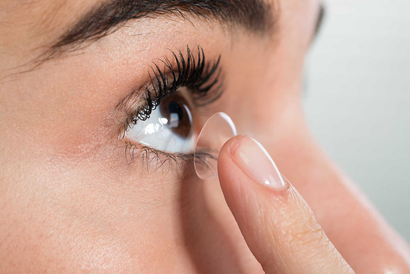 Sau mổ Lasik có thể đeo kính áp tròng không