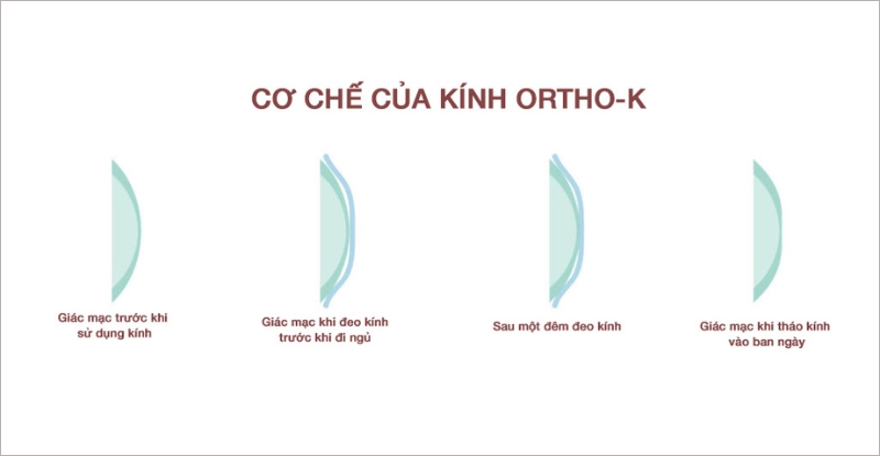 Cơ chế của kính Ortho-k