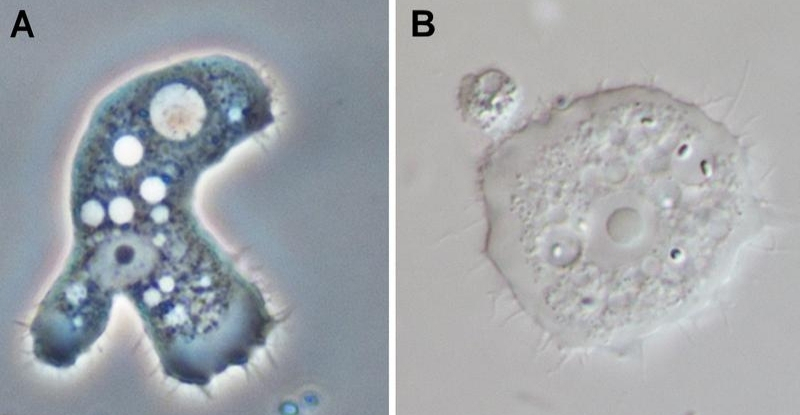 Acanthamoeba gây tổn thương giác mạc