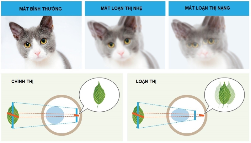 Mức độ loạn thị