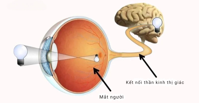 Ở người lớn, hệ thần kinh thị giác đã hình thành ổn định nên chữa nhược thị gặp khó khăn