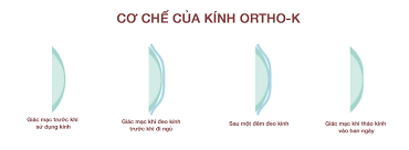 Kính Ortho-K
