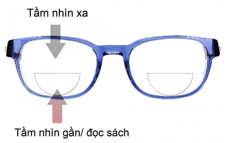 Tròng kính hai tròng Myopilux Max